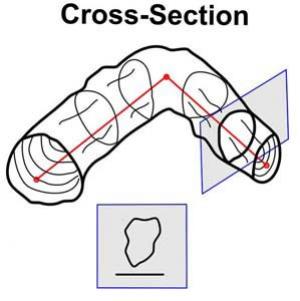 cross-section